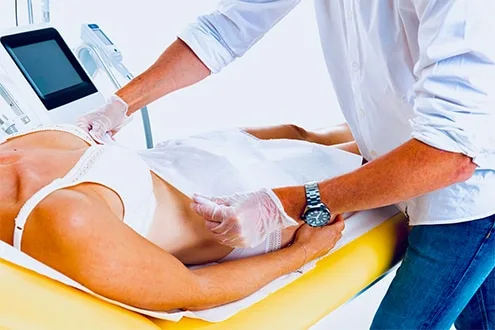 Pose de la membrane de protection sur l'abdomen, au début d'une séance de cryolipolyse